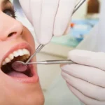 0170678001639425089-696x464-1-150x150 Dental